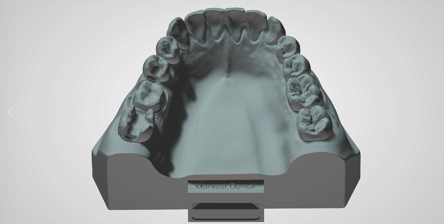 HarvestDental