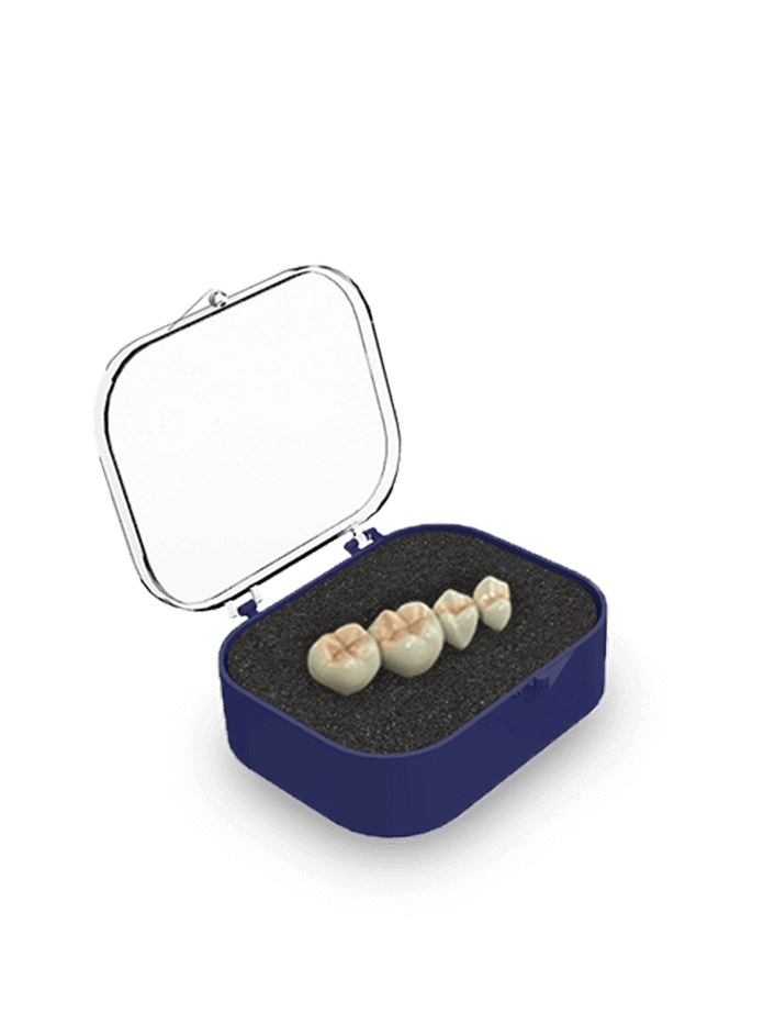 2" Rigid Bridge Box SH (Rounded), Blue/Clear w/Pre-Packed Foam (Charcoal Grey)